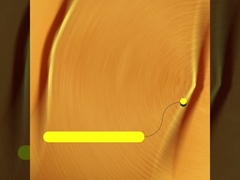 ورأى p84 إبرة كيس مرشح